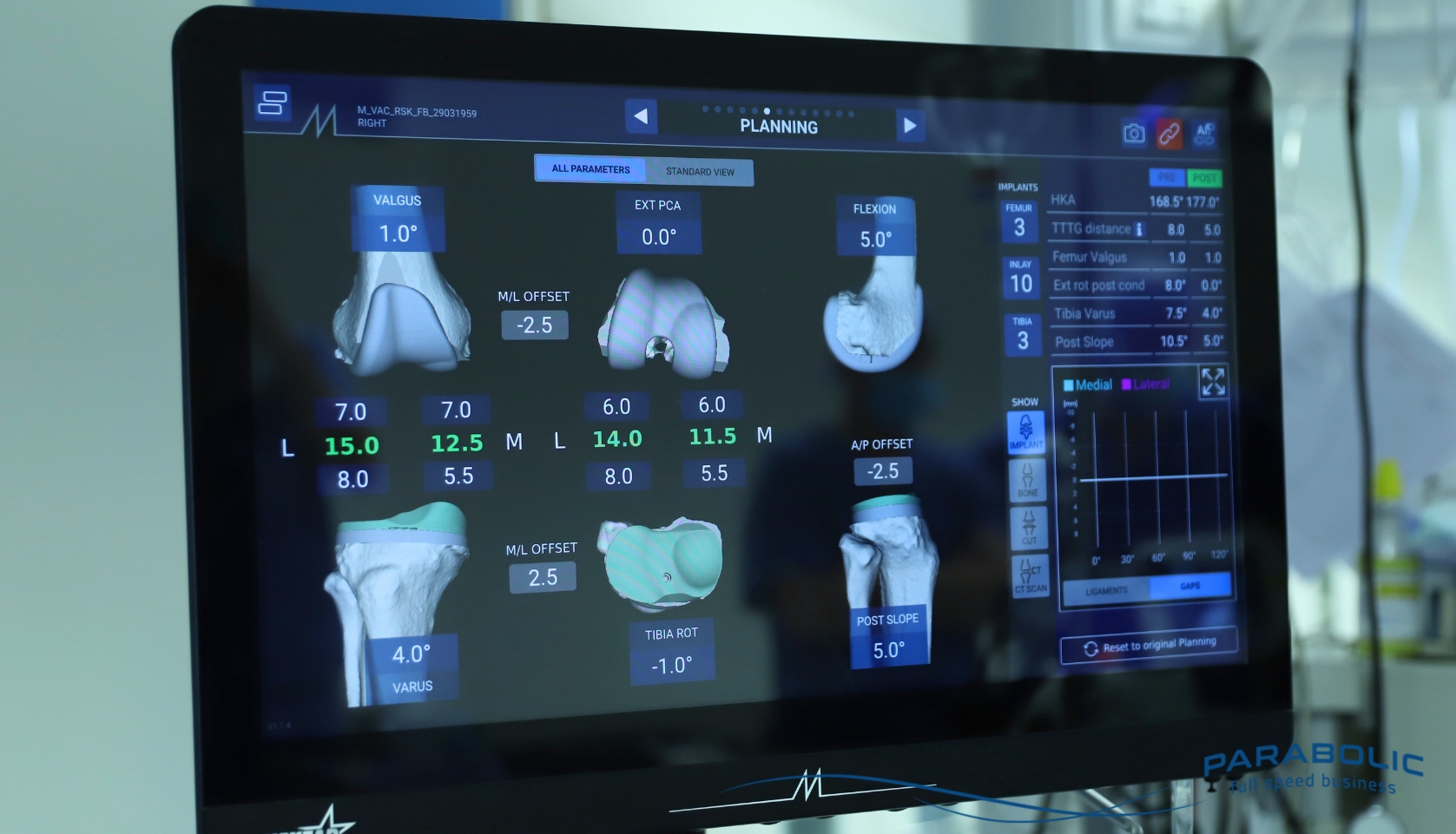 Animazione 3D che illustra in modo chiaro il funzionamento di un trattamento medico